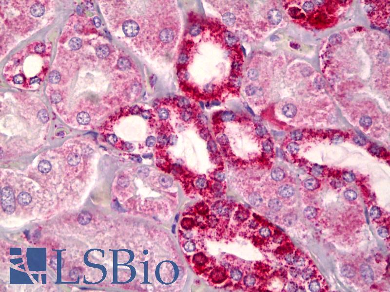 BCL2 / Bcl-2 Antibody - Anti-BCL2 / Bcl-2 antibody IHC of human kidney, tubules. Immunohistochemistry of formalin-fixed, paraffin-embedded tissue after heat-induced antigen retrieval. Antibody dilution 1:100.