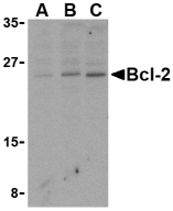 BCL2 / Bcl-2 Antibody - Western blot of Bcl-2 in Daudi cell lysates with Bcl-2 antibody at (A) 1, (B) 2, and (C) 4 ug/ml.