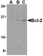 BCL2 / Bcl-2 Antibody - Western blot of Bcl-2 in A-20 cell lysates with Bcl-2 antibody at (A) 1, (B) 2, and (C) 4 ug/ml.