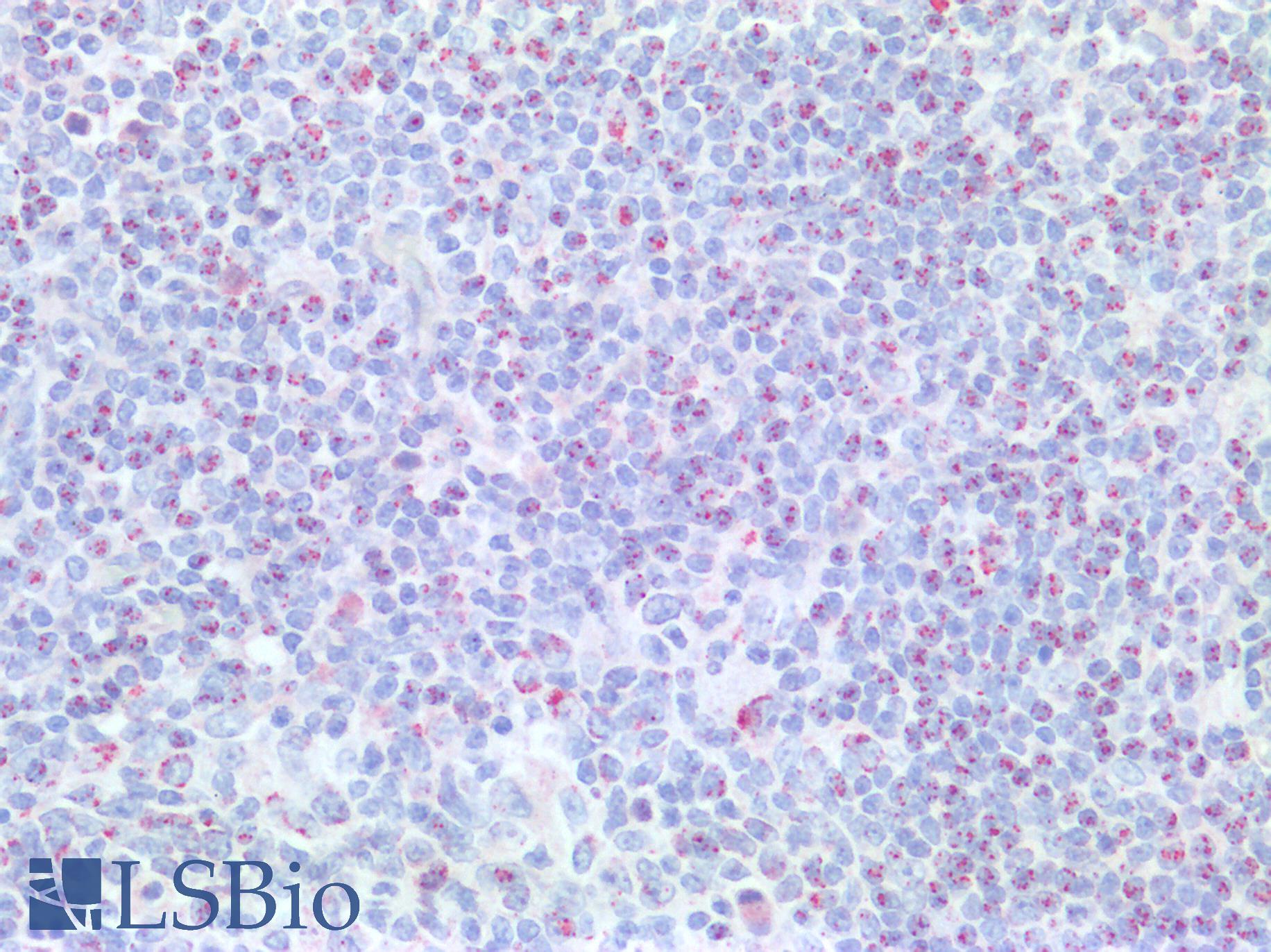 BCL2 / Bcl-2 Antibody - Human Tonsil: Formalin-Fixed, Paraffin-Embedded (FFPE)