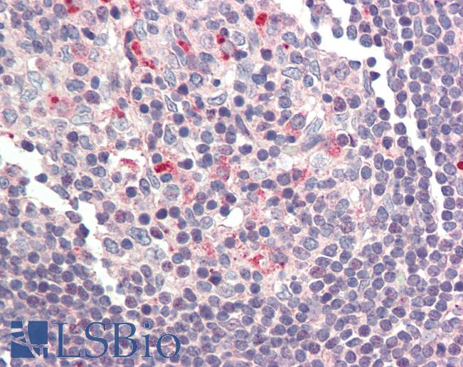 BCL2A1 Antibody - Anti-BCL2A1 antibody IHC of human small intestine, Peyer's patch. Immunohistochemistry of formalin-fixed, paraffin-embedded tissue after heat-induced antigen retrieval. Antibody concentration 5 ug/ml.