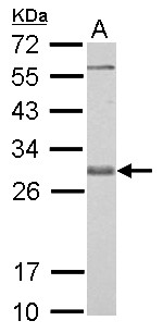 BCL2L1 / BCL-XL Antibody - Bcl-X antibody detects BCL2L1 protein by Western blot analysis. A. 30 ug PC-12 whole cell lysate/extract. 12 % SDS-PAGE. Bcl-X antibody dilution:1:1000