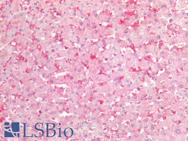 BCL2L1 / BCL-XL Antibody - Human Liver: Formalin-Fixed, Paraffin-Embedded (FFPE)