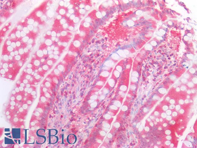 BCL2L1 / BCL-XL Antibody - Human Small Intestine: Formalin-Fixed, Paraffin-Embedded (FFPE)