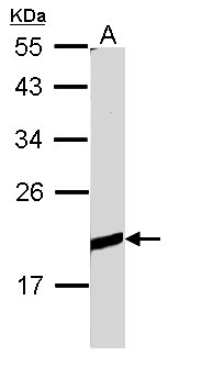 BCL2L10 / Diva Antibody - Sample (30 ug of whole cell lysate). A: Raji. 12% SDS PAGE. BCL-B / Diva antibody diluted at 1:1000.