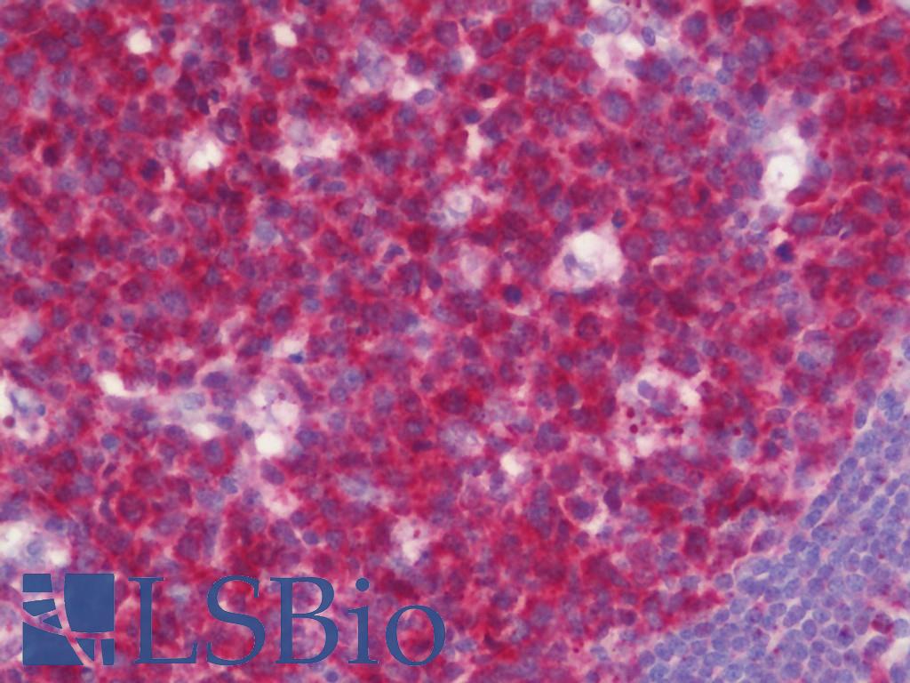 BCL2L10 / Diva Antibody - Anti-BCL2L10 / Diva antibody IHC staining of human tonsil. Immunohistochemistry of formalin-fixed, paraffin-embedded tissue after heat-induced antigen retrieval. Antibody concentration 7.5 ug/ml.