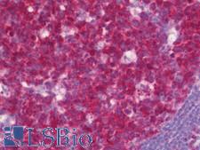 BCL2L10 / Diva Antibody - Anti-BCL2L10 / Diva antibody IHC staining of human tonsil. Immunohistochemistry of formalin-fixed, paraffin-embedded tissue after heat-induced antigen retrieval. Antibody concentration 7.5 ug/ml.