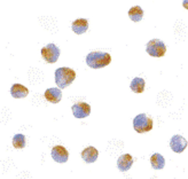 BCL2L10 / Diva Antibody - Immunocytochemistry of Bcl-B in Jurkat cells with Bcl-B antibody at 10 ug/ml.