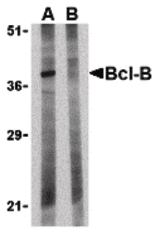 BCL2L10 / Diva Antibody - Western blot of Bcl-B in Jurkat lysate with Bcl-B antibody at 1 ug/ml in the (A) absence and (B) presence of blocking peptide.