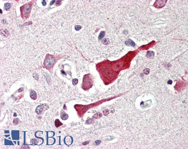 BCL2L10 / Diva Antibody - Anti-BCL2L10 / BCL-B antibody IHC of human brain, cortex. Immunohistochemistry of formalin-fixed, paraffin-embedded tissue after heat-induced antigen retrieval. Antibody concentration 5 ug/ml.