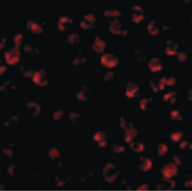 BCL2L11 / BIM Antibody - Immunofluorescence of Bim in K562 cells with Bim antibody at 20 ug/ml.