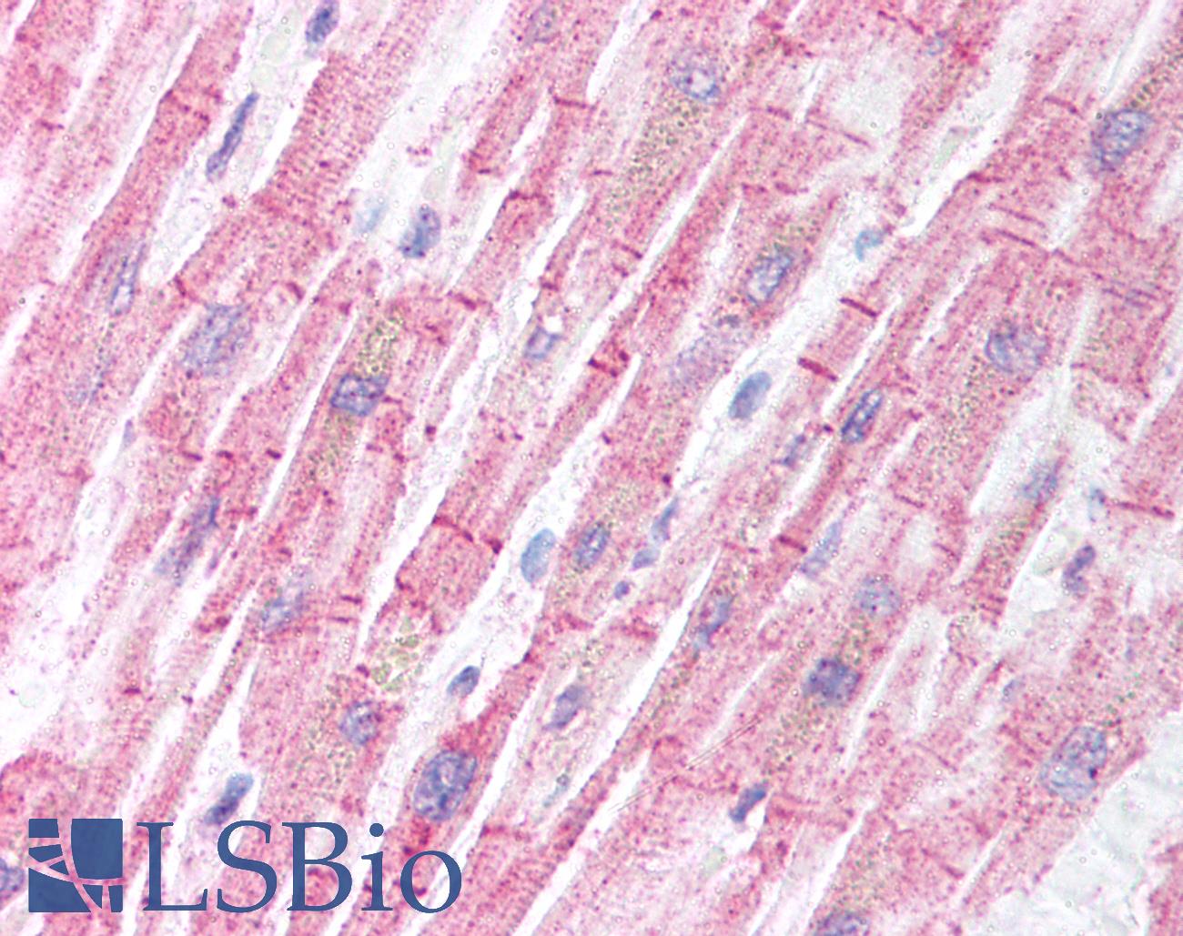 BCL2L11 / BIM Antibody - Anti-BCL2L11 / BIM antibody IHC of human heart. Immunohistochemistry of formalin-fixed, paraffin-embedded tissue after heat-induced antigen retrieval. Antibody concentration 5 ug/ml.