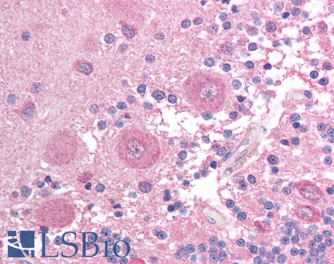 BCL2L14 / BCL-G Antibody - Anti-BCL2L14 / Bcl G antibody IHC of human brain, cerebellum. Immunohistochemistry of formalin-fixed, paraffin-embedded tissue after heat-induced antigen retrieval. Antibody concentration 2 ug/ml.