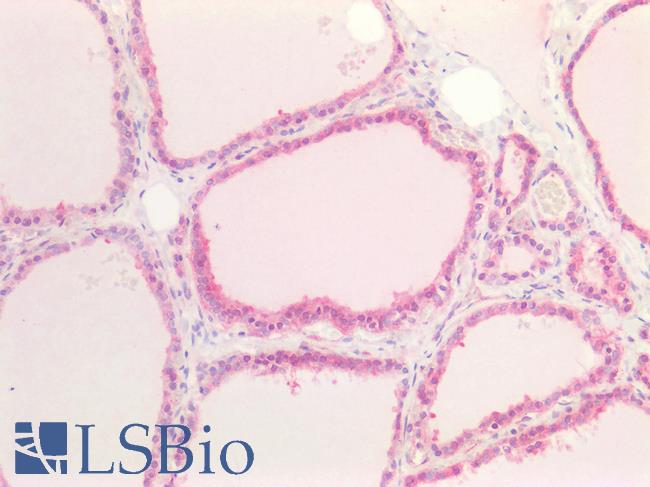 BCL2L2 / Bcl-w Antibody - Human Thyroid: Formalin-Fixed, Paraffin-Embedded (FFPE)