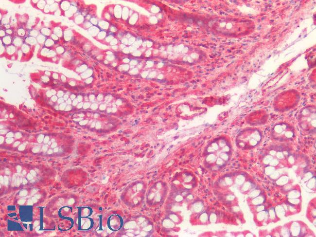 BCL2L2 / Bcl-w Antibody - Human Small Intestine: Formalin-Fixed, Paraffin-Embedded (FFPE)