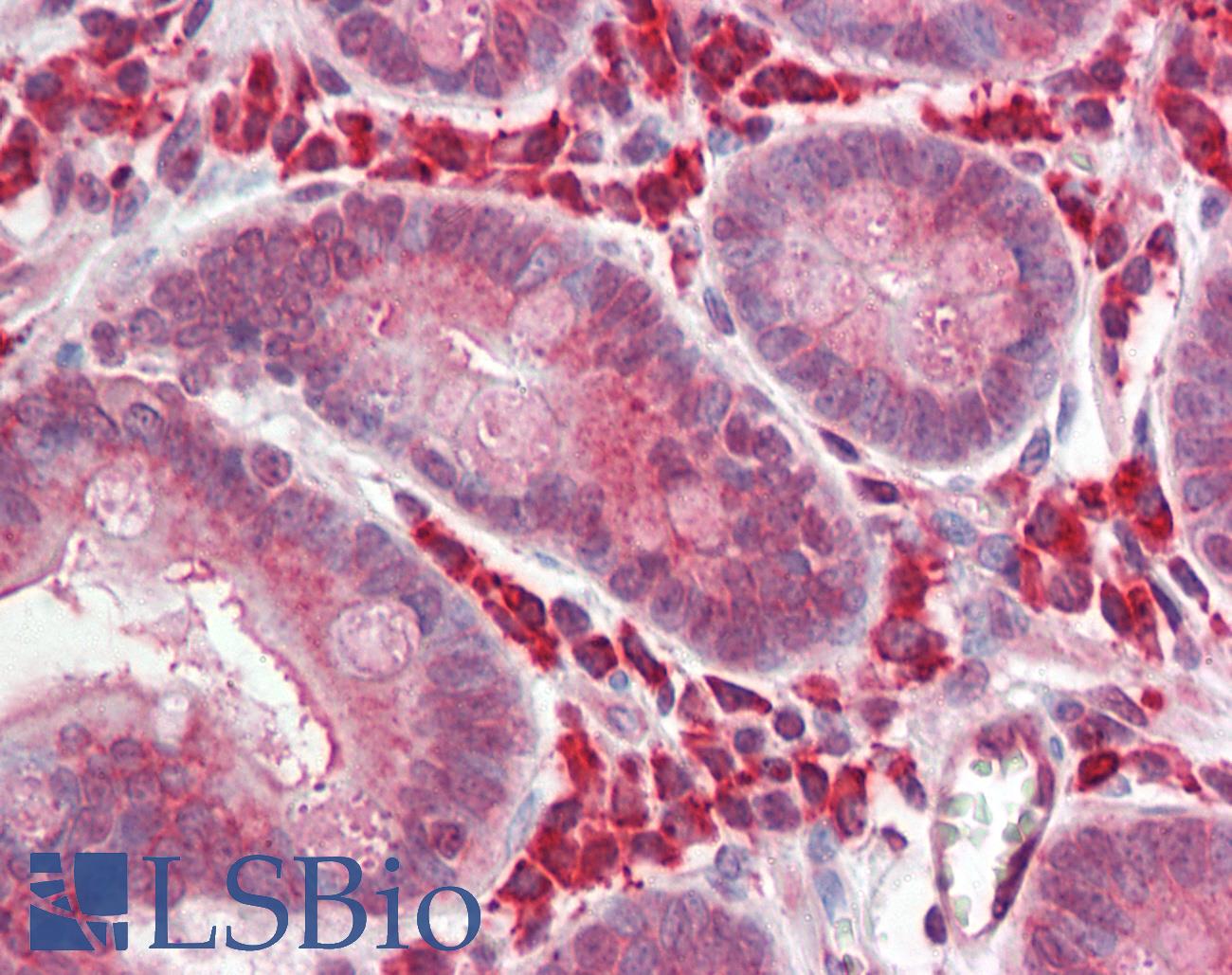 BCL3 / BCL-3 Antibody - Human Small Intestine: Formalin-Fixed, Paraffin-Embedded (FFPE)