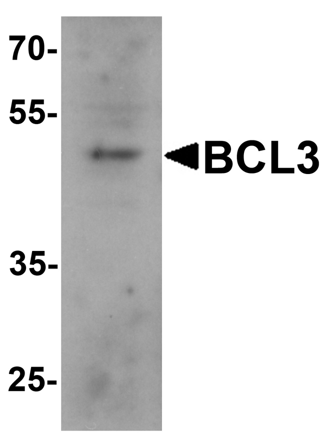 BCL3 / BCL-3 Antibody - Western blot analysis of BCL3 in 293 cell lysate with BCL3 antibody at 1 ug/ml.