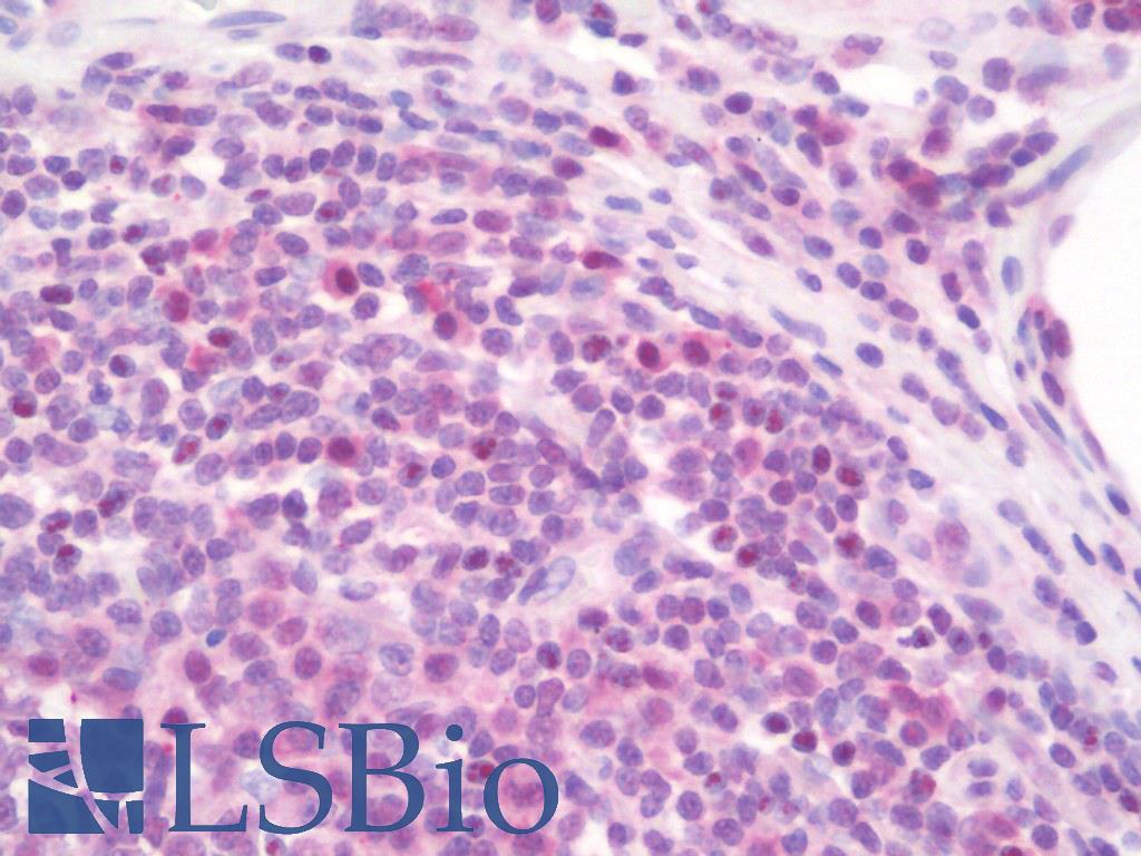 BCL3 / BCL-3 Antibody - Anti-BCL3 / BCL-3 antibody IHC staining of human tonsil. Immunohistochemistry of formalin-fixed, paraffin-embedded tissue after heat-induced antigen retrieval. Antibody concentration 10 ug/ml.