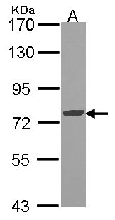 BCL6 Antibody - Sample (30 ug of whole cell lysate). A: JurKat. 7.5% SDS PAGE. BCL6 antibody. BCL6 antibody diluted at 1:1000. 