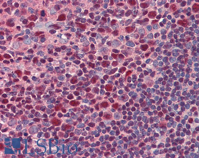BCL6 Antibody - Human Tonsil: Formalin-Fixed, Paraffin-Embedded (FFPE)