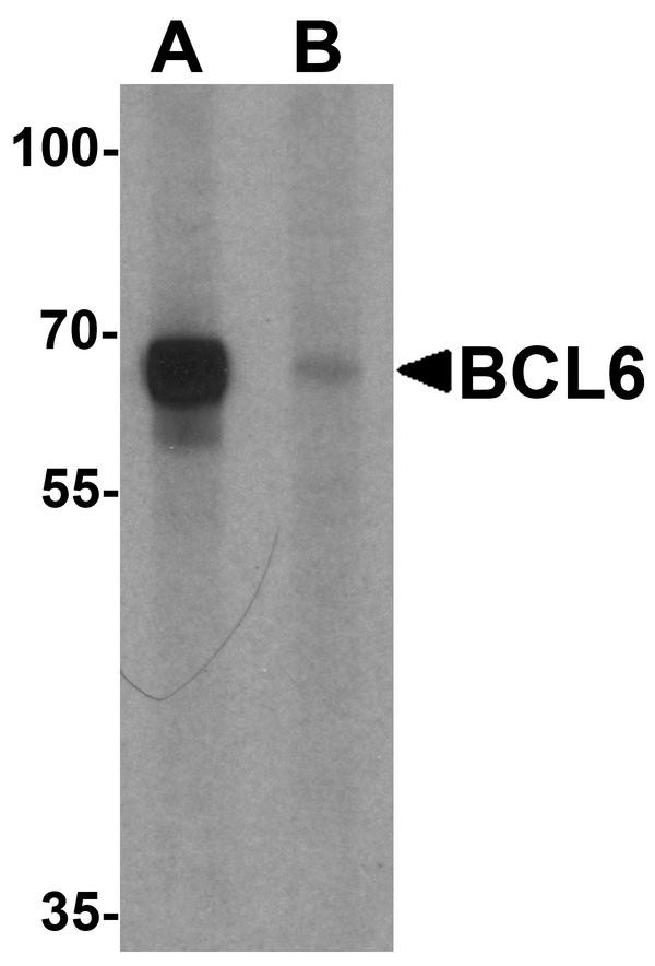 BCL6 Antibody - Western blot analysis of BCL6 in rat lung tissue lysate with Bcl6 antibody at 1 ug/ml in (A) the absence and (B) the presence of blocking peptide
