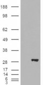 BDH2 Antibody - BDH2 / DHRS6 antibody (0.3µg/ml) staining of Human Kidney lysate (35µg protein in RIPA buffer). Detected by chemiluminescence.