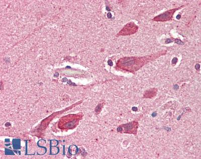 BECN2 Antibody - Human Brain, Cortex: Formalin-Fixed, Paraffin-Embedded (FFPE) at 10 µg/ml