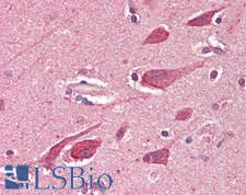 BECN2 Antibody - Human Brain, Cortex: Formalin-Fixed, Paraffin-Embedded (FFPE) at 10 µg/ml