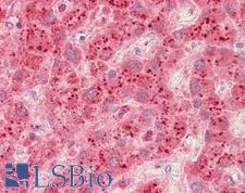 Beta Galactosidase Antibody - Anti-Beta Galactosidase antibody IHC staining of human liver. Immunohistochemistry of formalin-fixed, paraffin-embedded tissue after heat-induced antigen retrieval. Antibody concentration 5 ug/ml.