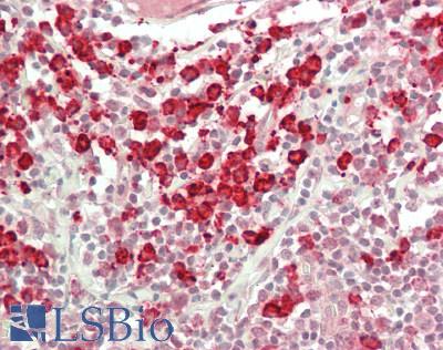 Betaglycan / TGFBR3 Antibody - Human Tonsil: Formalin-Fixed, Paraffin-Embedded (FFPE)