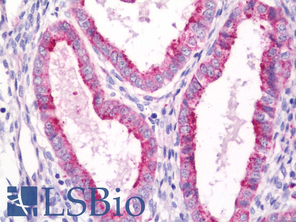 Betaglycan / TGFBR3 Antibody - Human Uterus, Endometrium: Formalin-Fixed, Paraffin-Embedded (FFPE)