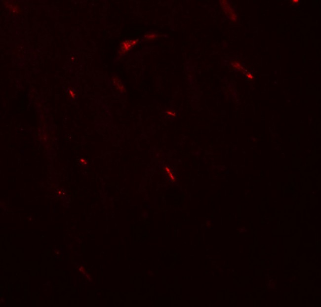 BF1 / FOXG1 Antibody - Immunofluorescence of FOXG1 in mouse brain tissue with FOXG1 antibody at 20 ug/ml.