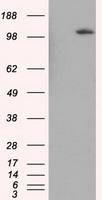 BHMT Antibody - HEK293T cells were transfected with the pCMV6-ENTRY control (Left lane) or pCMV6-ENTRY BHMT (Right lane) cDNA for 48 hrs and lysed. Equivalent amounts of cell lysates (5 ug per lane) were separated by SDS-PAGE and immunoblotted with anti-BHMT.