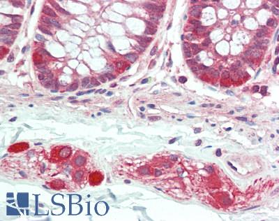 BICD1 Antibody - Human Colon: Formalin-Fixed, Paraffin-Embedded (FFPE), at a concentration of 5 ug/ml. 