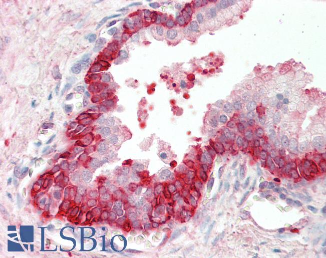 BID Antibody - Anti-BID antibody IHC staining of human prostate. Immunohistochemistry of formalin-fixed, paraffin-embedded tissue after heat-induced antigen retrieval. Antibody concentration 5 ug/ml.