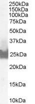 BID Antibody - BID antibody (0.1ug/ml) staining of A431 lysate (35ug protein in RIPA buffer). Detected by chemiluminescence.