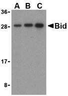 BID Antibody - Western blot of Bid in mouse lung cell lysates with Bid antibody at (A) 0.5, (B) 1, and (C) 2 ug/ml.