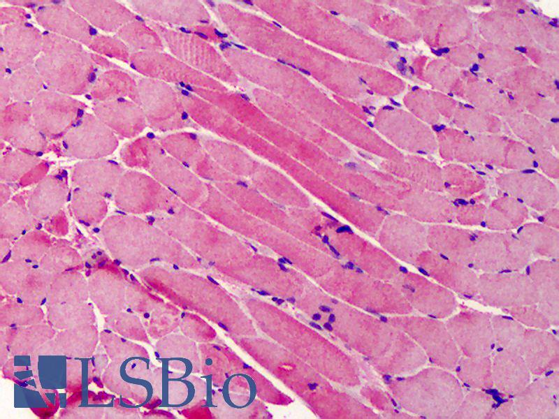 BID Antibody - Anti-BID antibody IHC of human skeletal muscle. Immunohistochemistry of formalin-fixed, paraffin-embedded tissue after heat-induced antigen retrieval. Antibody concentration 5 ug/ml.