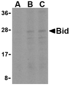 BID Antibody - Western blot of Bid in A549 cell lysates with Bid antibody at (A) 0.5, (B) 1, and (C) 2 ug/ml.