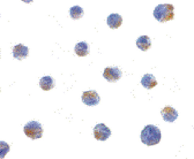BIK Antibody - Immunocytochemistry of BIK in Jurkat cells with BIK antibody at 1 ug/ml.