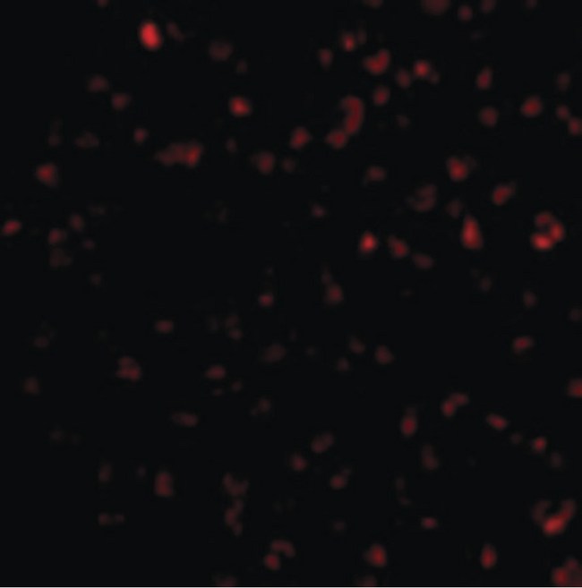 BIK Antibody - Immunofluorescence of Bik in Jurkat cells with Bik antibody at 10 ug/ml.