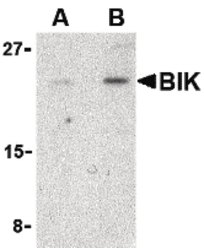 BIK Antibody - Western blot of BIK in Jurkat cell lysate with BIK antibody at (A) 1 and (B) 2 ug/ml.