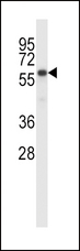 BIRC2 / cIAP1 Antibody - BIRC2 Antibody western blot of MDA-MB231 cell line lysates (35 ug/lane). The BIRC2 antibody detected the BIRC2 protein (arrow).