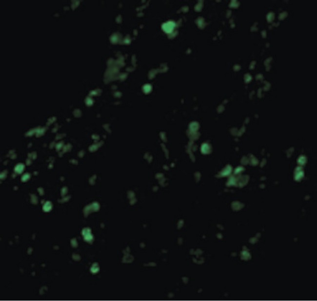 BIRC2 / cIAP1 Antibody - Immunofluorescence of cIAP in Human Lung cells with cIAP antibody at 20 ug/ml.