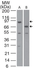 BIRC2 / cIAP1 Antibody - Western blot detection of c-IAP1 in human lung cell lysate. using antibody at 2 µg/ml dilution.
