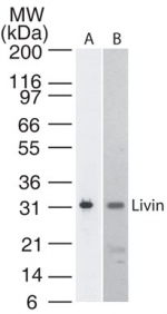 BIRC7 / Livin Antibody - Western blot detection of Livin in A) Livin transfected cell lysate and B) U266 cell lysate. A protein band of approximate molecular weight of 31 kDa is detected using antibody at 2 ug/ml dilution.