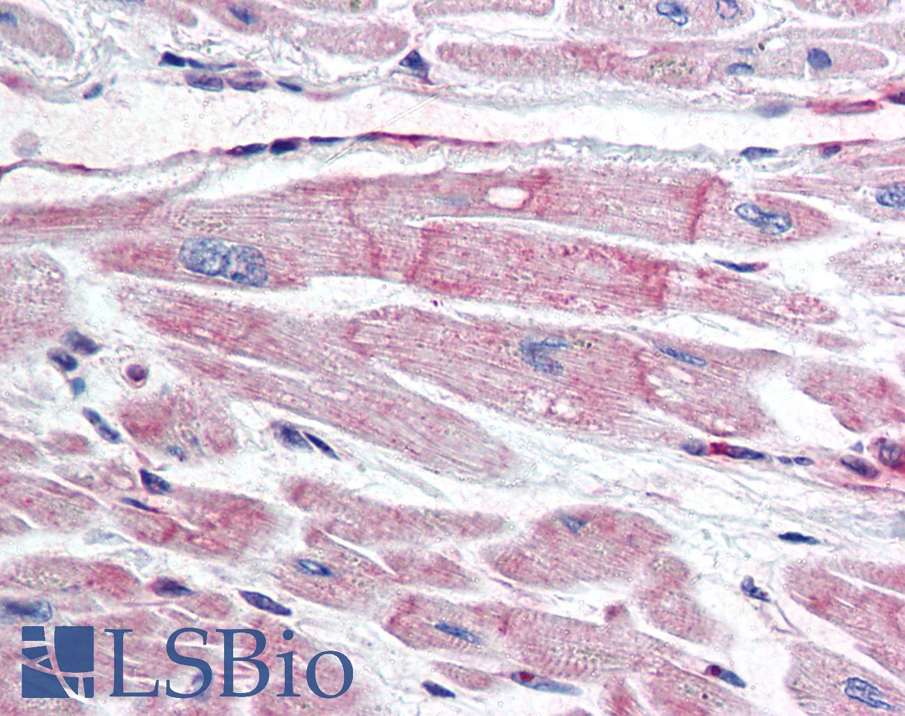 BIRC7 / Livin Antibody - Anti-BIRC7 / Livin antibody IHC of human heart. Immunohistochemistry of formalin-fixed, paraffin-embedded tissue after heat-induced antigen retrieval. Antibody concentration 10 ug/ml.