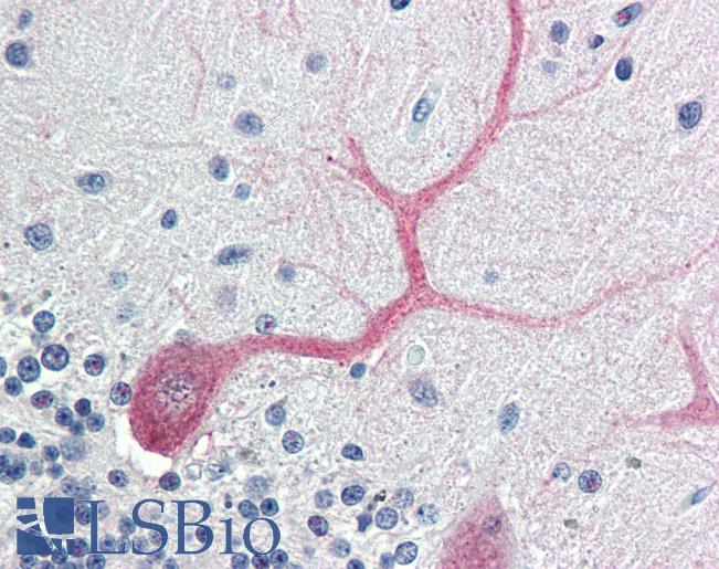 BIRC7 / Livin Antibody - Anti-BIRC7 / Livin antibody IHC of human brain, cerebellum. Immunohistochemistry of formalin-fixed, paraffin-embedded tissue after heat-induced antigen retrieval. Antibody concentration 5 ug/ml.