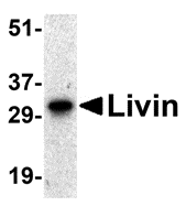 BIRC7 / Livin Antibody - Western blot analysis of Livin expression in human Raji cell lysate with Livin antibody at 0.5 ug/mL.