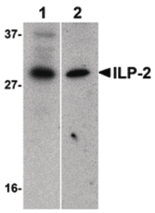 BIRC8 / ILP2 Antibody - Western blot of ILP-2 expression in human HepG2 (lane 1) and MOLT4 (lane 2) cell lysates with ILP-2 antibody at 1 ug/ml.